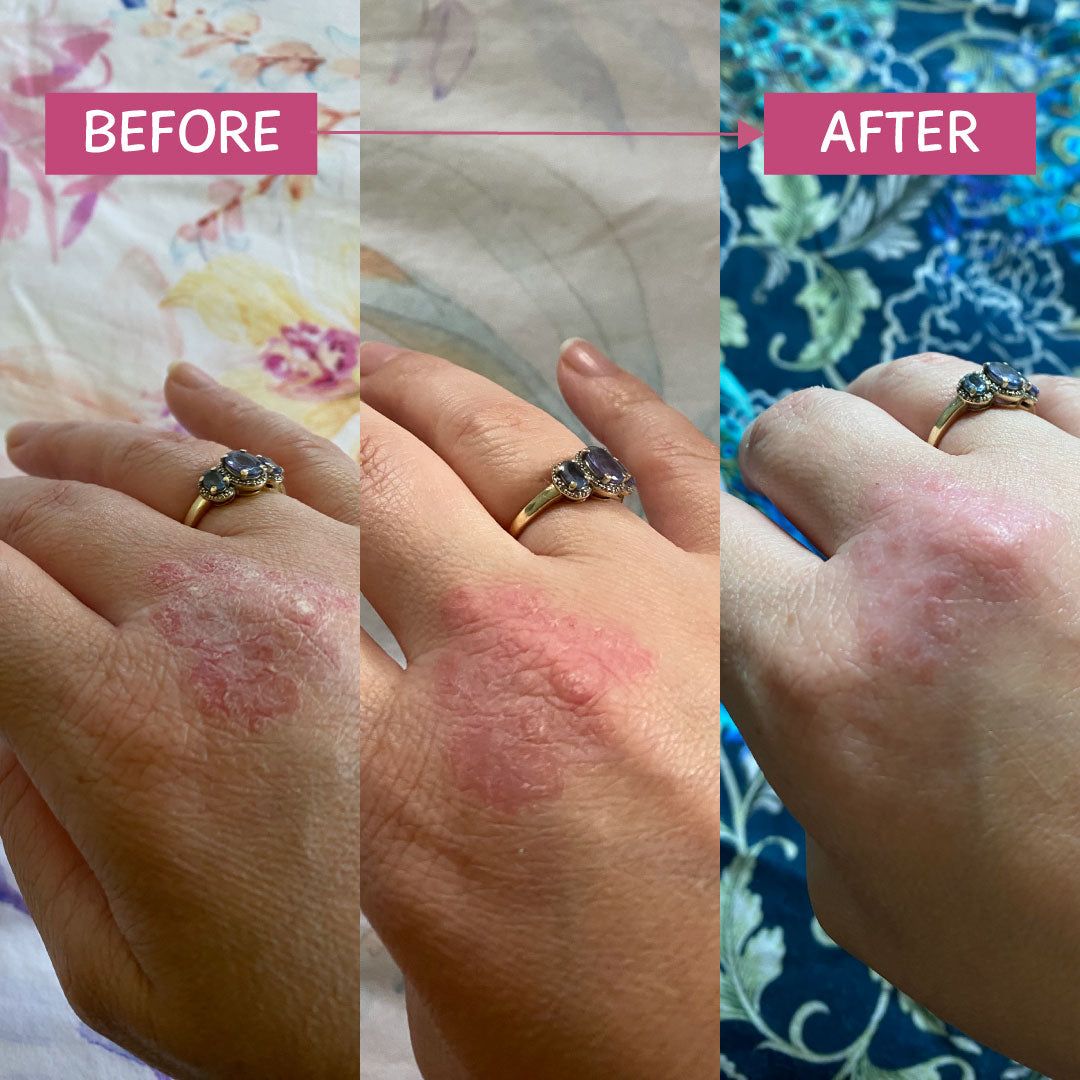 Pink Eczema Cream 120g