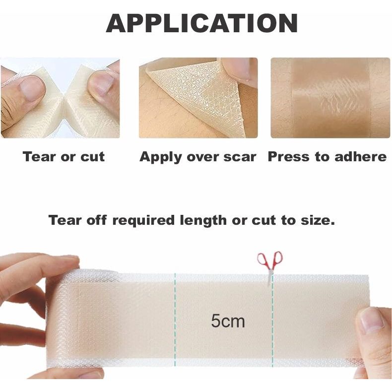 Bodyassist Silicone Scar Tape 4cm x 1.5m - STELLAR PHARMACY