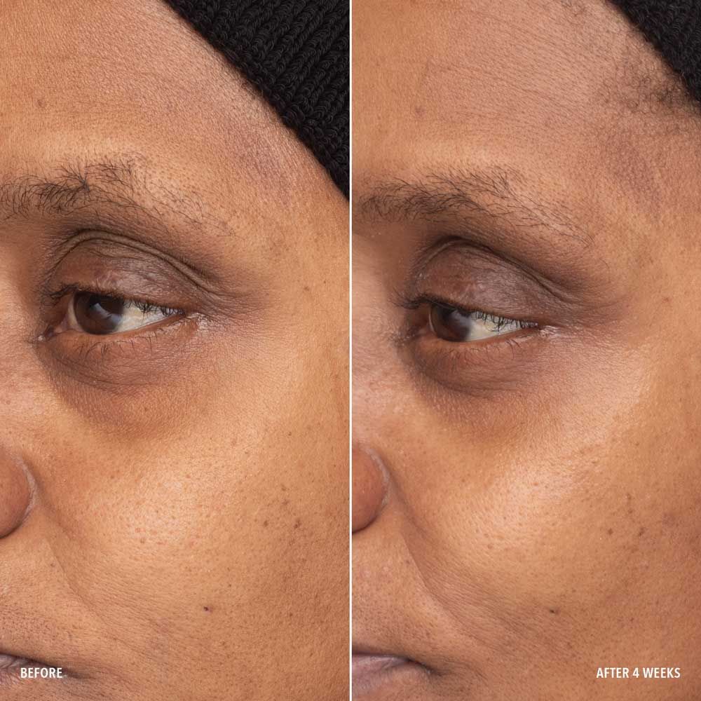 Retinol Eye Renewal
