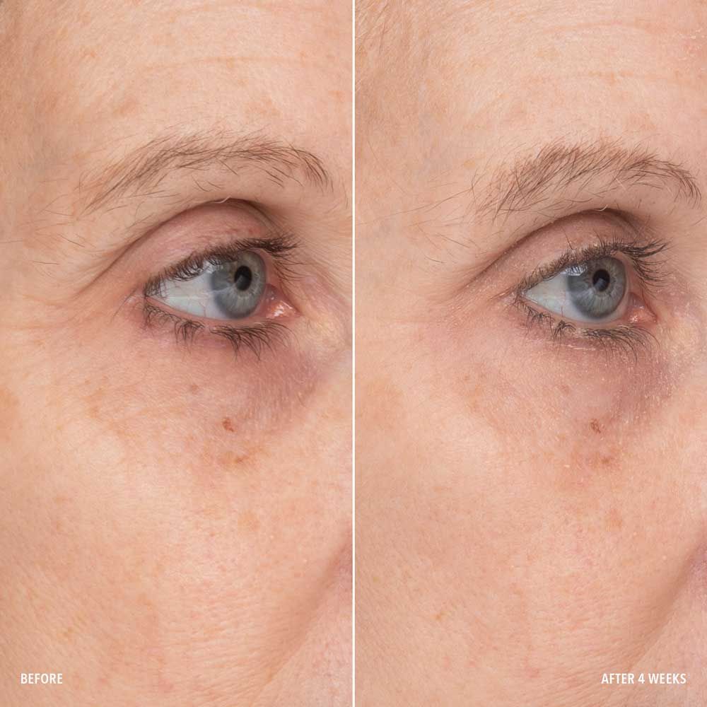 Retinol Eye Renewal